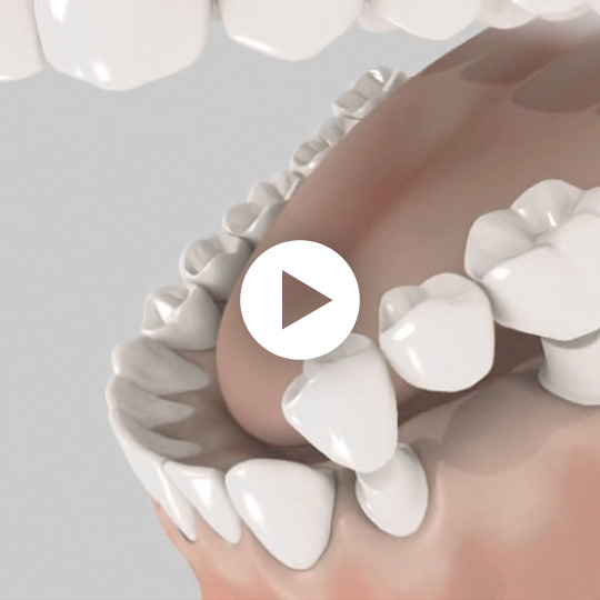 Animations 3D